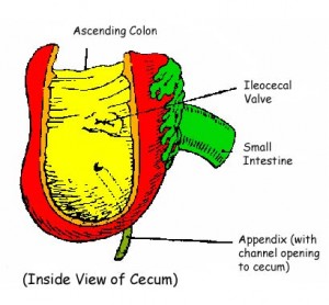 Appendix Pain – Symptoms, Causes, Location and Treatment